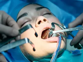 Oral Surgery Information Oral Surgery Information