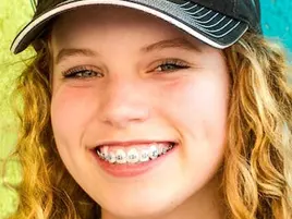 Orthodontics Orthodontics